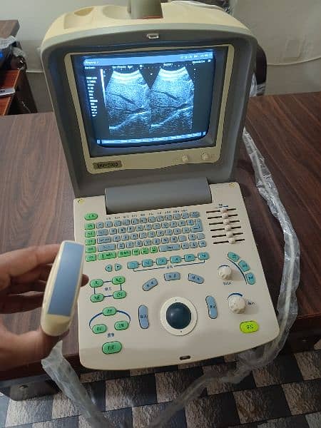 Ultrasound machine 9