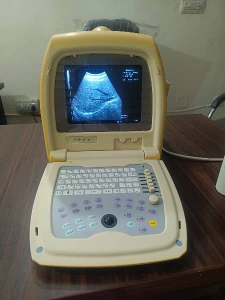 Ultrasound machine 3