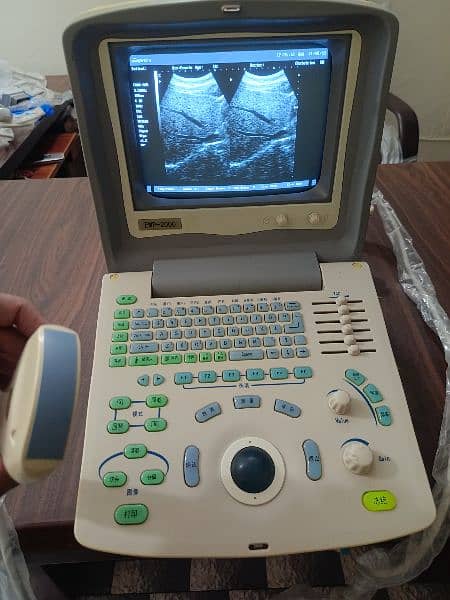 Ultrasound machine 5