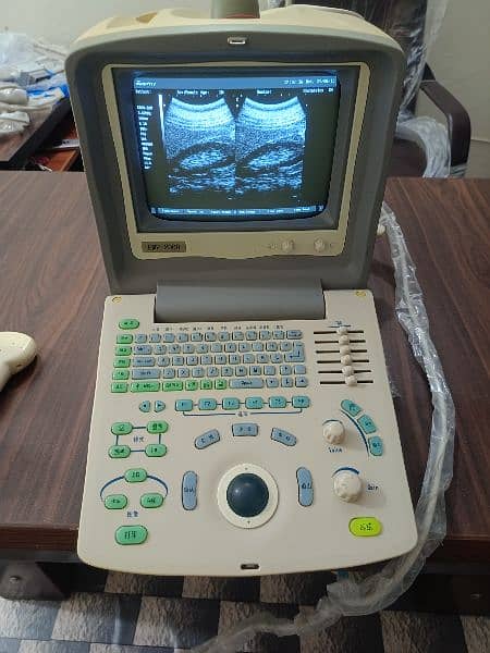 ultrasound machine 2