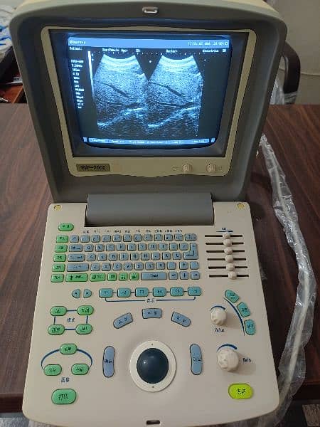 ultrasound machine 3