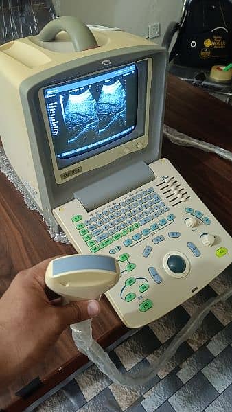 ultrasound machine 4