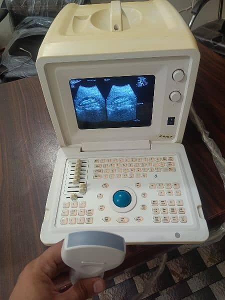 Ultrasound machine 3