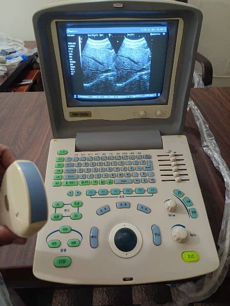 Ultrasound machine 4