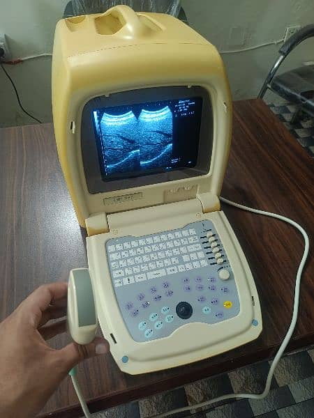 Ultrasound machine 1