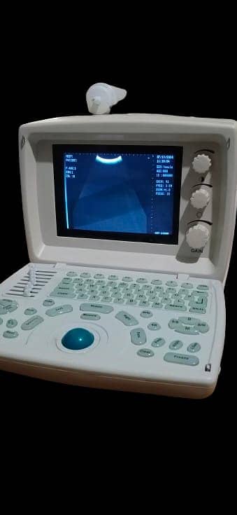 Ultra Sound Machine for Sale======Sold 3