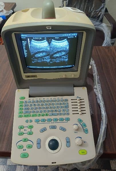 ultrasound machine 3