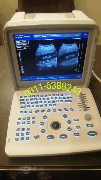 ultrasound machine 16