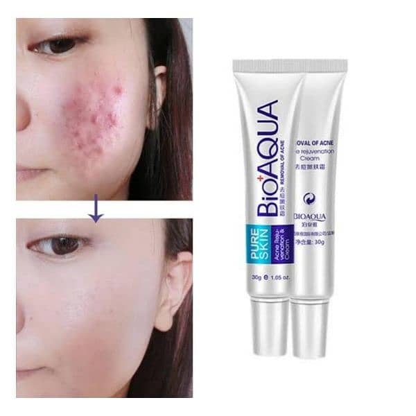 Acne Scar Removal Rejuvenation Cream. 0