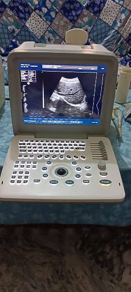 ultrasound machine ECG printer 0300*/  8888*965 18