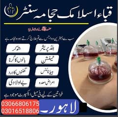 Hijama Service in Lahore