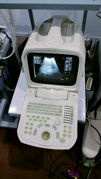 ultrasound machine ECG printer 0300/  *8888*965 5