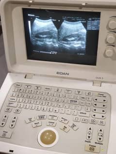 Ultrasound