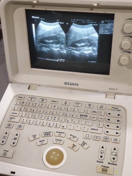 Ultrasound machine New Stock Available Whtsap-03126807471 0