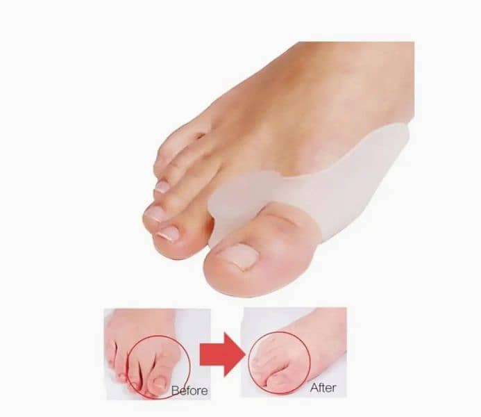 Alexvyan Toe straightener + 1 Pair Silicone Gel Bunion Protector Toe 7