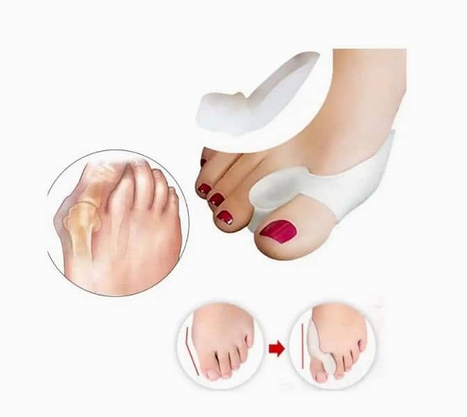 Alexvyan Toe straightener + 1 Pair Silicone Gel Bunion Protector Toe 9