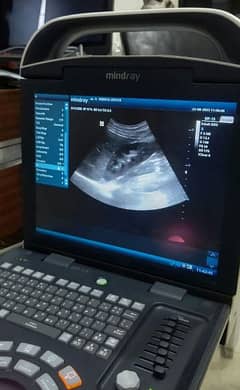 Mindray DP-15 Ultrasound Machine