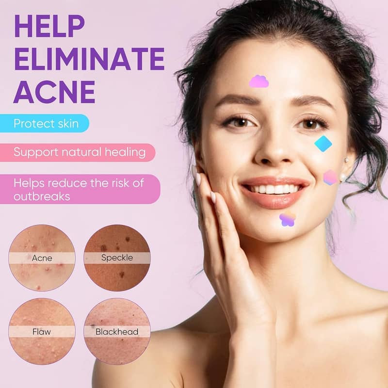 144Pcs Face Pimple Star Acne Patches, Hydrocolloid Fast Healing 4