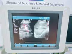 Ultrasound Color Doppler LCD Based Japani Import available