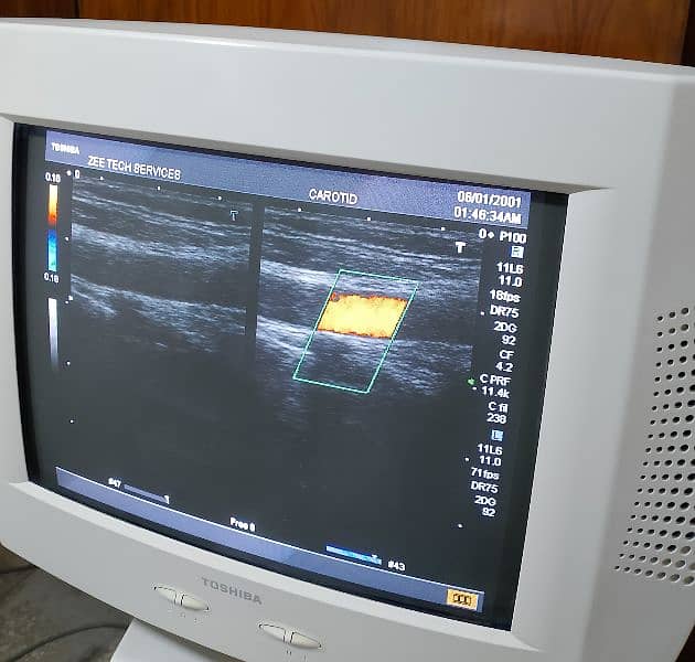 Ultrasound Machimus 03333338596 4