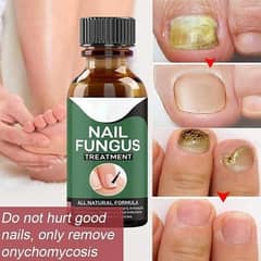 Fast Nail Fungal Treatments Nail treatment