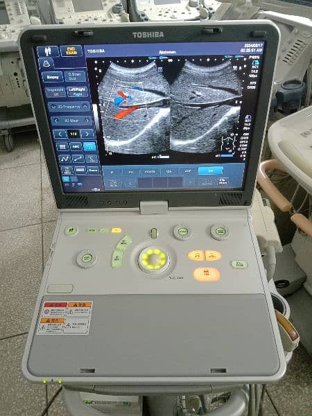 All Types Of Ultrasound Machines Available For Sale 6