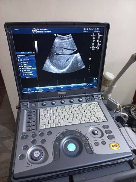 Ultrasound machines O3325OO8691 15