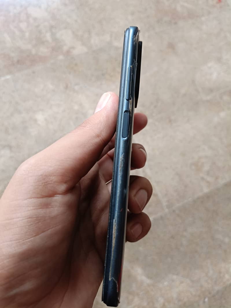 Redmi 10 prime 5