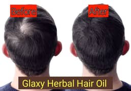 Galaxy hair harbal oil  Baldness is hair loss