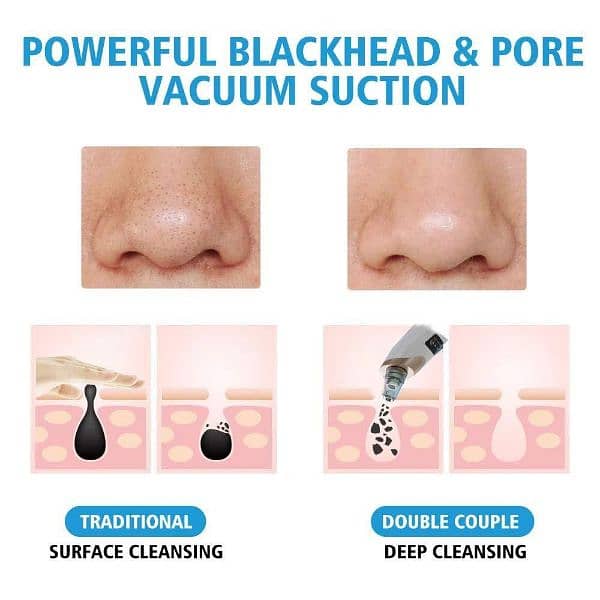 Portable Blackhead Pore Cleaner 1