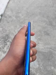 Redmi note 8 exchange possible