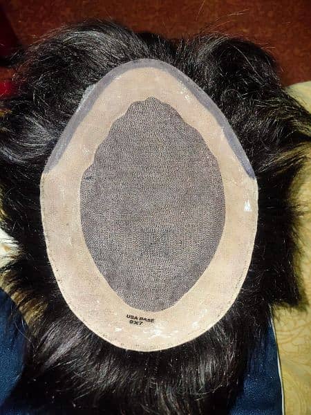 hair patch for men 1