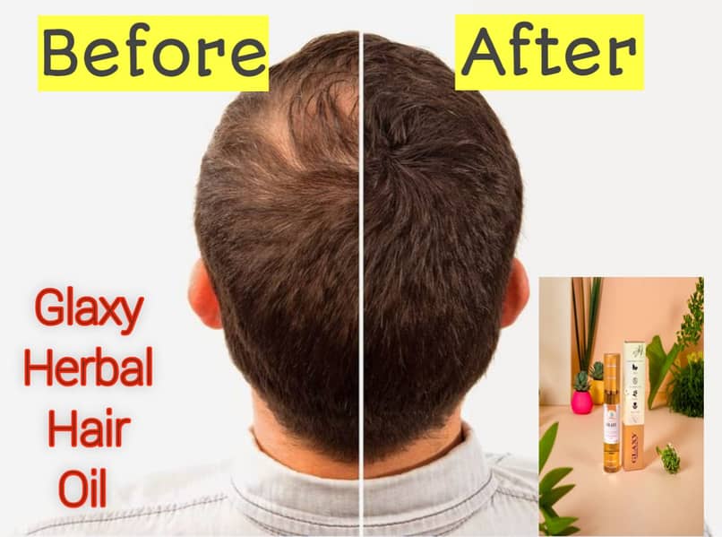 Galaxy hair herbal oil herbal oil hair fall 1