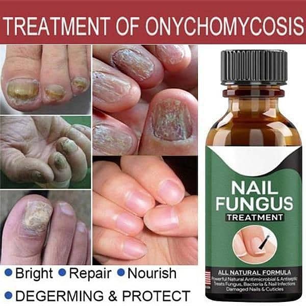 Fast Nail Fungal Treatment Nail Repair 2