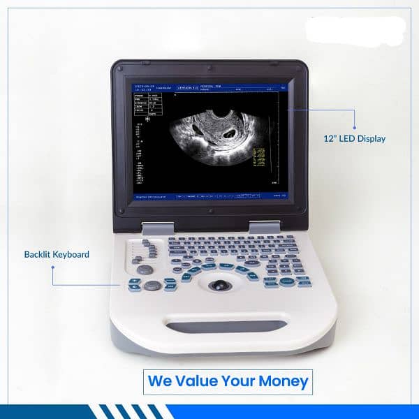 Brand new Nyro10 Notebook Ultrasound machines wholesale price in Paki 1