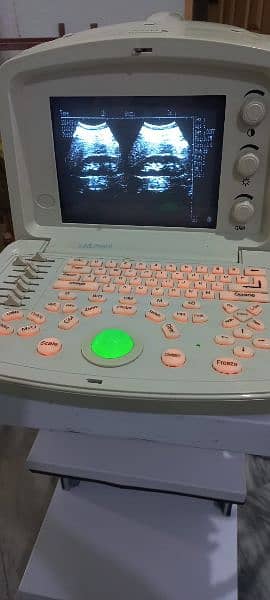 Chinese Ultrasound Machine 1