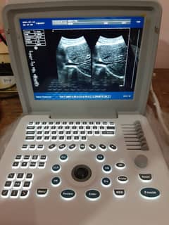 Ultrasound machine band new Chinese (with or without battery backup)