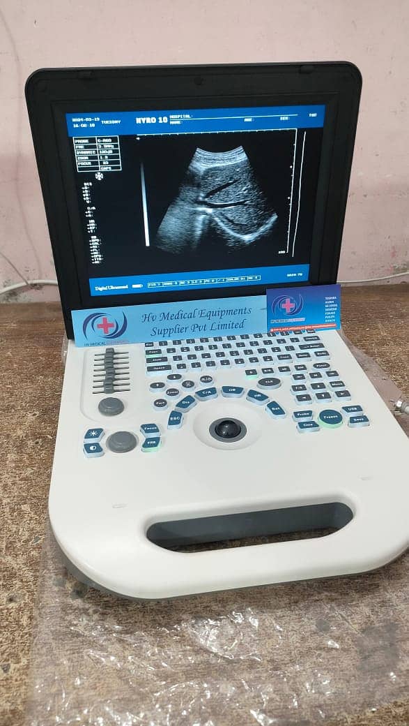 Ultrasound machine band new Chinese (with or without battery backup) 1