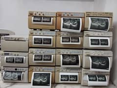 Referbish Ultrasound Printer Sony