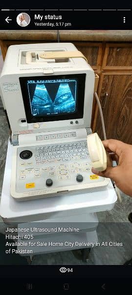 Ultrasound machine New China Available Whtsap-03126807471 1