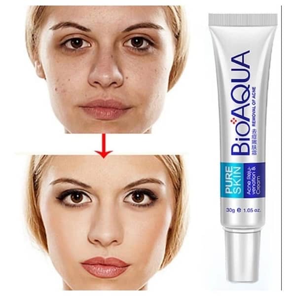 Acne scar Removal Rejuvenation cream 30 g 3