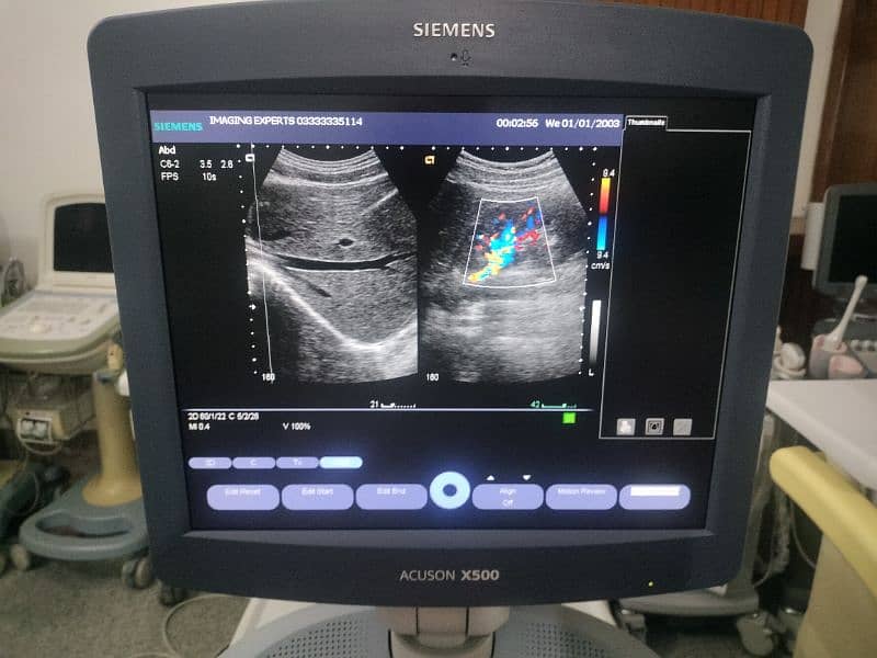 ultrasound Machine and Color Doppler LCD based with convex probe 3