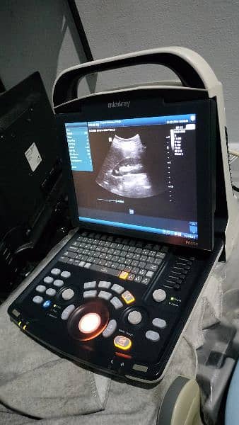 all kinds of ultrasound machines 0300 *8888*965 1