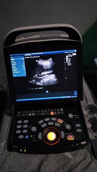 all kinds of ultrasound machines 0300 *8888*965 2