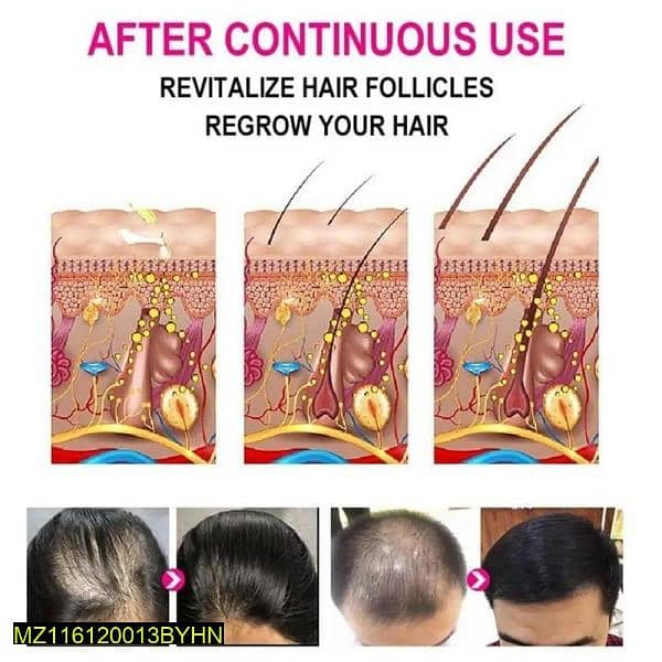 ANTI - Greying hair serum 30ML Box pack and growth and strong and hair 5