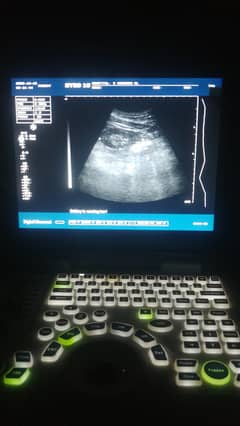 laptop ultrasound machine 0