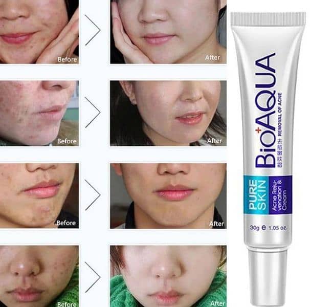 Acne Scar Removal Rejuvenation Cream 30gram 1