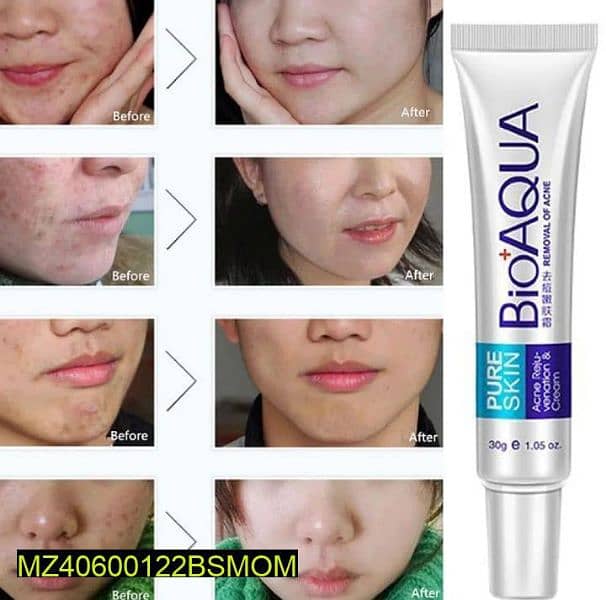 Acne Scar Removal Rejuvenation Cream 30gram 3