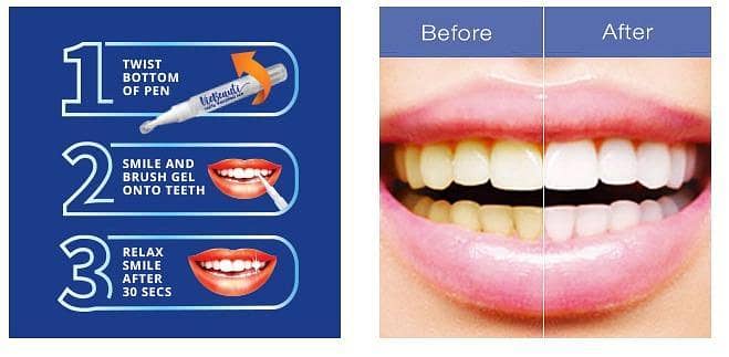 Teeth Whitening Pen 1