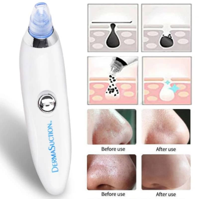 Derma Suction Pore Cleaning Device With Vacuum Action Face Pore Clean 1